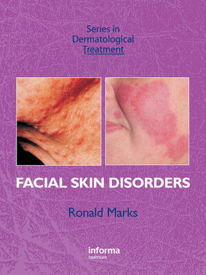 cover image of Facial Skin Disorders